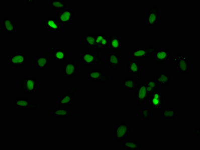 Immunofluorescence staining of Hela cells with HIST1H2AG (Ab-36) Antibody at 1:2.5, counter-stained with DAPI. The cells were fixed in 4% formaldehyde, permeabilized using 0.2% Triton X-100 and blocked in 10% normal Goat Serum. The cells were then incubated with the antibody overnight at 4°C. The secondary antibody was Alexa Fluor 488-congugated AffiniPure Goat Anti-Rabbit IgG(H+L).Rabbit anti-Human HIST1H2AG Polyclonal Antibody