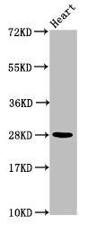 Western Blot  | Positive WB detected in: Mouse heart tissue  | All lanes: HIST1H2AG antibody at 1.04µg/ml  | Secondary  | Goat polyclonal to rabbit IgG at 1/50000 dilution  | Predicted band size: 15 kDa  | Observed band size: 28 kDaRabbit anti-Human HIST1H2AG Polyclonal Antibody
