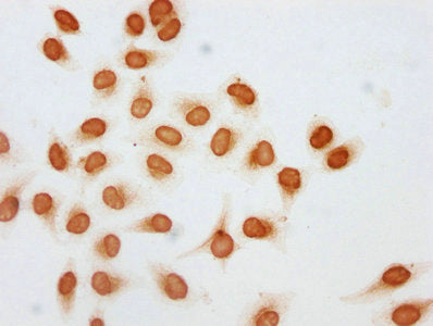 Immunocytochemistry analysis of Acetyl-HIST1H2AG (K74) Antibody diluted at 1:5 and staining in Hela cells (treated with 30mM sodium butyrate for 4h) performed on a Leica BondTM system. The cells were fixed in 4% formaldehyde, permeabilized using 0.2% Triton X-100 and blocked with 10% normal goat serum 30min at RT. Then primary antibody (1% BSA) was incubated at 4°C overnight. The primary is detected by a biotinylated secondary antibody and visualized using an HRP conjugated SP system.Rabbit anti-Human HIST1H2AG Polyclonal Antibody