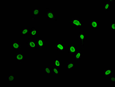 Immunofluorescence staining of Hela cells (treated with 30mM sodium butyrate for 4h) with Acetyl-HIST1H2AG (K74) Antibody at 1:2.5, counter-stained with DAPI. The cells were fixed in 4% formaldehyde, permeabilized using 0.2% Triton X-100 and blocked in 10% normal Goat Serum. The cells were then incubated with the antibody overnight at 4°C. The secondary antibody was Alexa Fluor 488-congugated AffiniPure Goat Anti-Rabbit IgG(H+L).Rabbit anti-Human HIST1H2AG Polyclonal Antibody