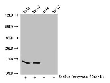 Western Blot  | Detected samples: Hela whole cell lysate, HepG2 whole cell lysate; Untreated (-) or treated (+) with 30mM sodium butyrate for 4h  | All lanes: HIST1H2AG antibody at 1:100  | Secondary  | Goat polyclonal to rabbit IgG at 1/50000 dilution  | Predicted band size: 15 kDa  | Observed band size: 15 kDaRabbit anti-Human HIST1H2AG Polyclonal Antibody