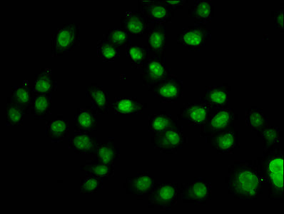 Immunofluorescence staining of Hela cells with HIST1H2AG (Ab-95) Antibody at 1:1, counter-stained with DAPI. The cells were fixed in 4% formaldehyde, permeabilized using 0.2% Triton X-100 and blocked in 10% normal Goat Serum. The cells were then incubated with the antibody overnight at 4°C. The secondary antibody was Alexa Fluor 488-congugated AffiniPure Goat Anti-Rabbit IgG(H+L).Rabbit anti-Human HIST1H2AG Polyclonal Antibody
