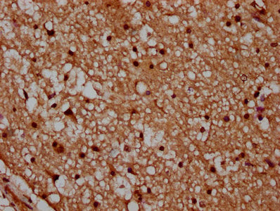 IHC image of HIST1H2AG (Ab-95) Antibody diluted at 1:20 and staining in paraffin-embedded human brain tissue performed on a Leica BondTM system. After dewaxing and hydration, antigen retrieval was mediated by high pressure in a citrate buffer (pH 6.0). Section was blocked with 10% normal goat serum 30min at RT. Then primary antibody (1% BSA) was incubated at 4°C overnight. The primary is detected by a biotinylated secondary antibody and visualized using an HRP conjugated SP system.Rabbit anti-Human HIST1H2AG Polyclonal Antibody