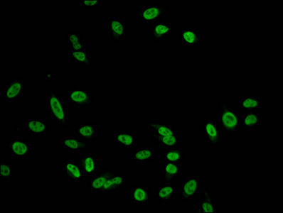 Immunofluorescent analysis of Hela cells using HIST1H2AG (Ab-101) Antibody at dilution of 1:100 and Alexa Fluor 488-congugated AffiniPure Goat Anti-Rabbit IgG(H+L)Rabbit anti-Human HIST1H2AG Polyclonal Antibody