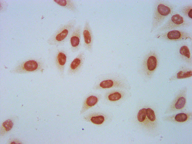 Immunocytochemistry analysis of Crotonyl-HIST1H2AG (K118) Antibody diluted at 1:50 and staining in Hela cells (treated with 30mM sodium crotonylate for 4h) performed on a Leica BondTM system. The cells were fixed in 4% formaldehyde, permeabilized using 0.2% Triton X-100 and blocked with 10% normal goat serum 30min at RT. Then primary antibody (1% BSA) was incubated at 4°C overnight. The primary is detected by a biotinylated secondary antibody and visualized using an HRP conjugated SP system.Rabbit anti-Human HIST1H2AG Polyclonal Antibody