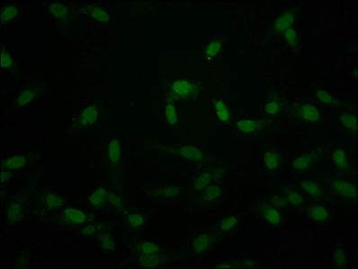Immunofluorescence staining of Hela cells with the antibody at 1:50, counter-stained with DAPI. The cells were fixed in 4% formaldehyde, permeabilized using 0.2% Triton X-100 and blocked in 10% normal Goat Serum. The cells were then incubated with the antibody overnight at 4°C. The secondary antibody was Alexa Fluor 488-congugated AffiniPure Goat Anti-Rabbit IgG(H+L).Rabbit anti-Human HIST1H2AG Polyclonal Antibody