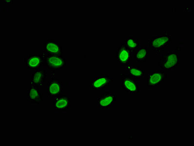 Immunofluorescence staining of Hela cells with HIST1H2AG (Ab-119) Antibody at 1:5, counter-stained with DAPI. The cells were fixed in 4% formaldehyde, permeabilized using 0.2% Triton X-100 and blocked in 10% normal Goat Serum. The cells were then incubated with the antibody overnight at 4°C. The secondary antibody was Alexa Fluor 488-congugated AffiniPure Goat Anti-Rabbit IgG(H+L).Rabbit anti-Human HIST1H2AG Polyclonal Antibody