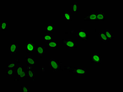 Immunofluorescent analysis of Hela cells using HIST1H2AG (Ab-125) Antibody at dilution of 1:100 and Alexa Fluor 488-congugated AffiniPure Goat Anti-Rabbit IgG(H+L)Rabbit anti-Human HIST1H2AG Polyclonal Antibody