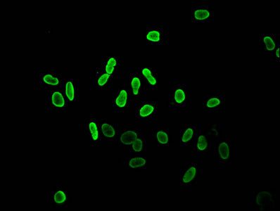 Immunofluorescent analysis of Hela cells (sodium butyrate, 30 mM, 4h) using Acetyl-HIST1H2AG (K36) Antibody at dilution of 1:100 and Alexa Fluor 488-congugated AffiniPure Goat Anti-Rabbit IgG(H+L)Rabbit anti-Human HIST1H2AG Polyclonal Antibody