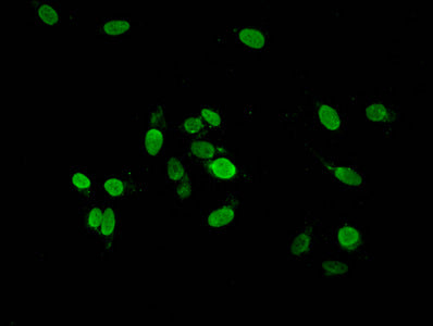Immunofluorescent analysis of Hela cells using HIST1H2AG (Ab-36) Antibody at dilution of 1:100 and Alexa Fluor 488-congugated AffiniPure Goat Anti-Rabbit IgG(H+L)Rabbit anti-Human HIST1H2AG Polyclonal Antibody