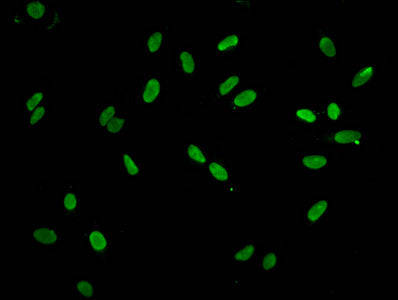Immunofluorescent analysis of Hela cells using HIST1H2AG (Ab-95) Antibody at dilution of 1:100 and Alexa Fluor 488-congugated AffiniPure Goat Anti-Rabbit IgG(H+L)Rabbit anti-Human HIST1H2AG Polyclonal Antibody