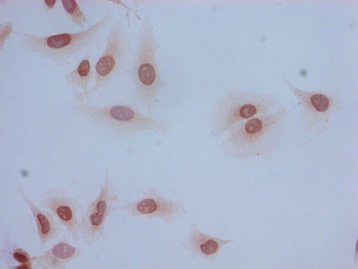 Immunocytochemistry analysis of Hela cells using the antibody at dilution of 1:100Rabbit anti-Human HIST1H2BB Polyclonal Antibody