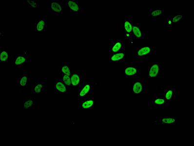 Immunofluorescent analysis of Hela cells using Acetyl-HIST1H2BB (K5) Antibody at dilution of 1:100 and Alexa Fluor 488-congugated AffiniPure Goat Anti-Rabbit IgG(H+L)Rabbit anti-Human HIST1H2BB Polyclonal Antibody
