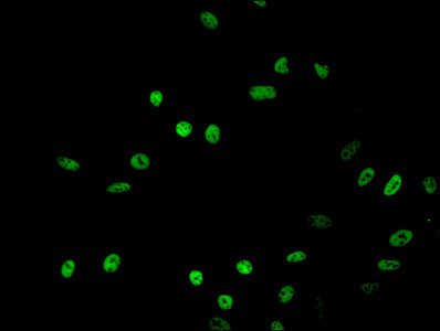 Immunofluorescent analysis of Hela cells treated with NaB using Acetyl-HIST1H2BB (K16) Antibody at dilution of 1:100 and Alexa Fluor 488-congugated AffiniPure Goat Anti-Rabbit IgG(H+L)Rabbit anti-Human HIST1H2BB Polyclonal Antibody