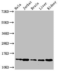 Western Blot  | Positive WB detected in: Hela cell acid extracts, Jurkat cell acid extracts, Mouse brain tissue, Mouse liver tissue, Mouse kidney tissue  | All lanes: HIST1H2BB antibody at 2.5µg/ml  | Secondary  | Goat polyclonal to rabbit IgG at 1/50000 dilution  | Predicted band size: 14 kDa  | Observed band size: 14 kDaRabbit anti-Human HIST1H2BB Polyclonal Antibody