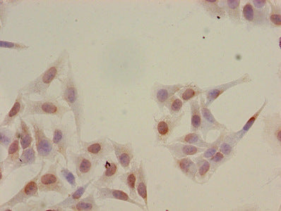 Immunocytochemistry analysis of Hela cells using Acetyl-HIST1H2BB (K16) Antibody at dilution of 1:100Rabbit anti-Human HIST1H2BB Polyclonal Antibody