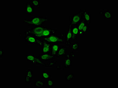 Immunofluorescent analysis of Hela cells using Acetyl-HIST1H2BB (K16) Antibody at dilution of 1:100 and Alexa Fluor 488-congugated AffiniPure Goat Anti-Rabbit IgG(H+L)Rabbit anti-Human HIST1H2BB Polyclonal Antibody