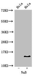 Western Blot  | Positive WB detected in: Hela cell acid extracts treated by NaB  | All lanes: HIST1H2BB antibody at 2µg/ml  | Secondary  | Goat polyclonal to rabbit IgG at 1/50000 dilution  | Predicted band size: 14 kDa  | Observed band size: 14 kDaRabbit anti-Human HIST1H2BB Polyclonal Antibody