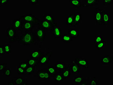 Immunofluorescence staining of Hela cells (treated with 30mM sodium butyrate for 4h) with Butyrly-HIST1H2BC (K5) Antibody at 1:15, counter-stained with DAPI. The cells were fixed in 4% formaldehyde, permeabilized using 0.2% Triton X-100 and blocked in 10% normal Goat Serum. The cells were then incubated with the antibody overnight at 4°C. The secondary antibody was Alexa Fluor 488-congugated AffiniPure Goat Anti-Rabbit IgG(H+L).Rabbit anti-Human HIST1H2BC Polyclonal Antibody
