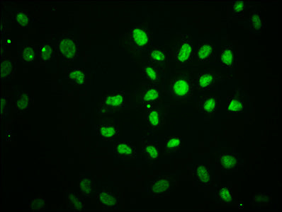 Immunofluorescence staining of Hela cells with HIST1H2BC (Ab-5) Antibody at 1:1, counter-stained with DAPI. The cells were fixed in 4% formaldehyde, permeabilized using 0.2% Triton X-100 and blocked in 10% normal Goat Serum. The cells were then incubated with the antibody overnight at 4°C. The secondary antibody was Alexa Fluor 488-congugated AffiniPure Goat Anti-Rabbit IgG(H+L).Rabbit anti-Human HIST1H2BC Polyclonal Antibody