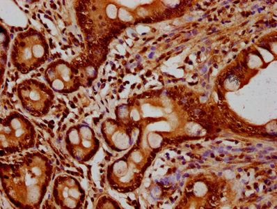 IHC image of HIST1H2BC (Ab-5) Antibody diluted at 1:10 and staining in paraffin-embedded human small intestine tissue performed on a Leica BondTM system. After dewaxing and hydration, antigen retrieval was mediated by high pressure in a citrate buffer (pH 6.0). Section was blocked with 10% normal goat serum 30min at RT. Then primary antibody (1% BSA) was incubated at 4°C overnight. The primary is detected by a biotinylated secondary antibody and visualized using an HRP conjugated SP system.Rabbit anti-Human HIST1H2BC Polyclonal Antibody