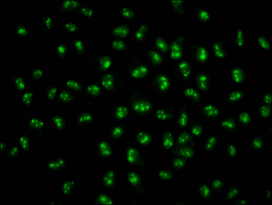 Immunofluorescence staining of Hela cells with HIST1H2BC (Ab-5) Antibody at 1:1, counter-stained with DAPI. The cells were fixed in 4% formaldehyde, permeabilized using 0.2% Triton X-100 and blocked in 10% normal Goat Serum. The cells were then incubated with the antibody overnight at 4°C. The secondary antibody was Alexa Fluor 488-congugated AffiniPure Goat Anti-Rabbit IgG(H+L).Rabbit anti-Human HIST1H2BC Polyclonal Antibody