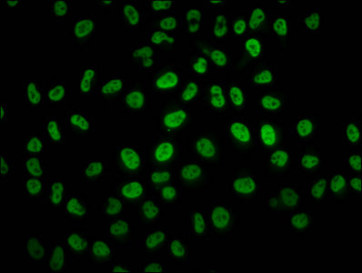Immunofluorescence staining of Hela cells with HIST1H2BC (Ab-5) Antibody at 1:1.5, counter-stained with DAPI. The cells were fixed in 4% formaldehyde, permeabilized using 0.2% Triton X-100 and blocked in 10% normal Goat Serum. The cells were then incubated with the antibody overnight at 4°C. The secondary antibody was Alexa Fluor 488-congugated AffiniPure Goat Anti-Rabbit IgG(H+L).Rabbit anti-Human HIST1H2BC Polyclonal Antibody