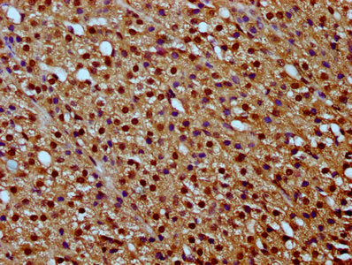 IHC image of HIST1H2BC (Ab-5) Antibody diluted at 1:20 and staining in paraffin-embedded human adrenal gland tissue performed on a Leica BondTM system. After dewaxing and hydration, antigen retrieval was mediated by high pressure in a citrate buffer (pH 6.0). Section was blocked with 10% normal goat serum 30min at RT. Then primary antibody (1% BSA) was incubated at 4°C overnight. The primary is detected by a biotinylated secondary antibody and visualized using an HRP conjugated SP system.Rabbit anti-Human HIST1H2BC Polyclonal Antibody