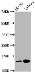 Western Blot  | Positive WB detected in: HL60 whole cell lysate, Rat spleen tissue  | All lanes: HIST1H2BC antibody at 0.45µg/ml  | Secondary  | Goat polyclonal to rabbit IgG at 1/50000 dilution  | Predicted band size: 14 kDa  | Observed band size: 14 kDaRabbit anti-Human HIST1H2BC Polyclonal Antibody