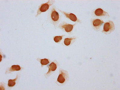 Immunocytochemistry analysis of the antibody diluted at 1:5 and staining in Hela cells (treated with 30mM sodium butyrate for 4h) performed on a Leica BondTM system. The cells were fixed in 4% formaldehyde, permeabilized using 0.2% Triton X-100 and blocked with 10% normal goat serum 30min at RT. Then primary antibody (1% BSA) was incubated at 4°C overnight. The primary is detected by a biotinylated secondary antibody and visualized using an HRP conjugated SP system.Rabbit anti-Human HIST1H2BC Polyclonal Antibody