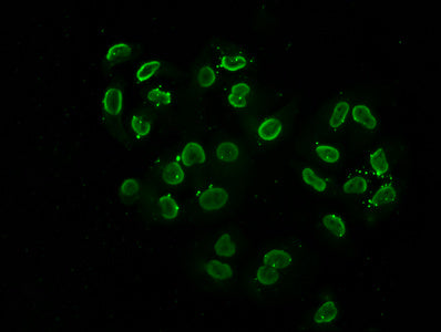 Immunofluorescence staining of Hela cells (treated with 30mM sodium butyrate for 4h) with Acetyl-HIST1H2BC (K108) Antibody at 1:2.5, counter-stained with DAPI. The cells were fixed in 4% formaldehyde, permeabilized using 0.2% Triton X-100 and blocked in 10% normal Goat Serum. The cells were then incubated with the antibody overnight at 4°C. The secondary antibody was Alexa Fluor 488-congugated AffiniPure Goat Anti-Rabbit IgG(H+L).Rabbit anti-Human HIST1H2BC Polyclonal Antibody