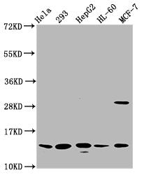 Western Blot  | Positive WB detected in: Hela whole cell lysate, 293 whole cell lysate, HepG2 whole cell lysate, HL60 whole cell lysate, MCF-7 whole cell lysate  | All lanes: HIST1H2BC antibody at 0.79µg/ml  | Secondary  | Goat polyclonal to rabbit IgG at 1/50000 dilution  | Predicted band size: 14 kDa  | Observed band size: 14 kDaRabbit anti-Human HIST1H2BC Polyclonal Antibody