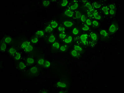 Immunofluorescence staining of Hela cells (treated with 30mM sodium butyrate for 4h) with Acetyl-HIST1H2BC (K116) Antibody at 1:2.5, counter-stained with DAPI. The cells were fixed in 4% formaldehyde, permeabilized using 0.2% Triton X-100 and blocked in 10% normal Goat Serum. The cells were then incubated with the antibody overnight at 4°C. The secondary antibody was Alexa Fluor 488-congugated AffiniPure Goat Anti-Rabbit IgG(H+L).Rabbit anti-Human HIST1H2BC Polyclonal Antibody