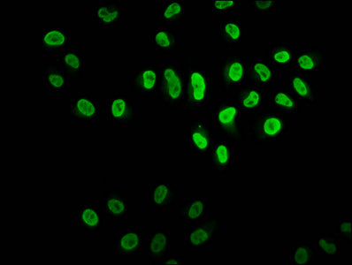 Immunofluorescence staining of Hela cells with HIST1H2BC (Ab-116) Antibody at 1:2.5, counter-stained with DAPI. The cells were fixed in 4% formaldehyde, permeabilized using 0.2% Triton X-100 and blocked in 10% normal Goat Serum. The cells were then incubated with the antibody overnight at 4°C. The secondary antibody was Alexa Fluor 488-congugated AffiniPure Goat Anti-Rabbit IgG(H+L).Rabbit anti-Human HIST1H2BC Polyclonal Antibody