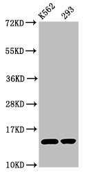 Western Blot  | Positive WB detected in: K562 whole cell lysate, 293 whole cell lysate  | All lanes: HIST1H2BC antibody at 0.72µg/ml  | Secondary  | Goat polyclonal to rabbit IgG at 1/50000 dilution  | Predicted band size: 14 kDa  | Observed band size: 14 kDaRabbit anti-Human HIST1H2BC Polyclonal Antibody