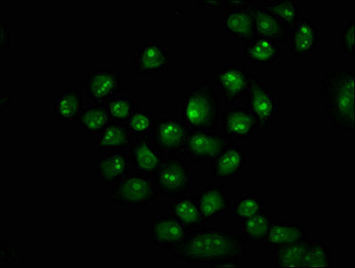 Immunofluorescence staining of Hela cells with HIST1H2BC (Ab-116) Antibody at 1:5, counter-stained with DAPI. The cells were fixed in 4% formaldehyde, permeabilized using 0.2% Triton X-100 and blocked in 10% normal Goat Serum. The cells were then incubated with the antibody overnight at 4°C. The secondary antibody was Alexa Fluor 488-congugated AffiniPure Goat Anti-Rabbit IgG(H+L).Rabbit anti-Human HIST1H2BC Polyclonal Antibody