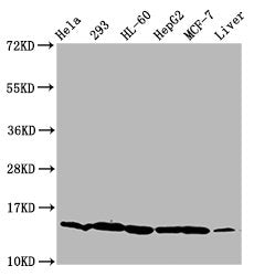 Western Blot  | Positive WB detected in: Hela whole cell lysate, 293 whole cell lysate, HL60 whole cell lysate, HepG2 whole cell lysate, MCF-7 whole cell lysate, Mouse liver tissue  | All lanes: HIST1H2BC antibody at 0.92µg/ml  | Secondary  | Goat polyclonal to rabbit IgG at 1/50000 dilution  | Predicted band size: 14 kDa  | Observed band size: 14 kDaRabbit anti-Human HIST1H2BC Polyclonal Antibody