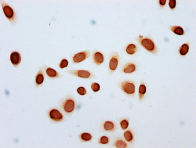 Immunocytochemistry analysis of Acetyl-HIST1H2BC (K11) Antibody diluted at 1:20 and staining in Hela cells (treated with 30mM sodium butyrate for 4h) performed on a Leica BondTM system. The cells were fixed in 4% formaldehyde, permeabilized using 0.2% Triton X-100 and blocked with 10% normal goat serum 30min at RT. Then primary antibody (1% BSA) was incubated at 4°C overnight. The primary is detected by a biotinylated secondary antibody and visualized using an HRP conjugated SP system.Rabbit anti-Human HIST1H2BC Polyclonal Antibody