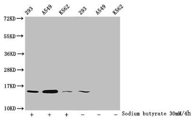 Western Blot  | Detected samples: 293 whole cell lysate, A549 whole cell lysate, K562 whole cell lysate; Untreated (-) or treated (+) with 30mM sodium butyrate for 4h  | All lanes: HIST1H2BC antibody at 1:100  | Secondary  | Goat polyclonal to rabbit IgG at 1/50000 dilution  | Predicted band size: 14 kDa  | Observed band size: 14 kDaRabbit anti-Human HIST1H2BC Polyclonal Antibody