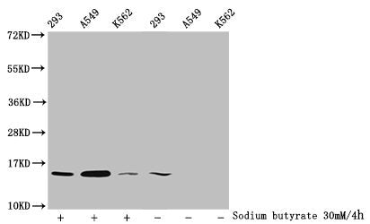 Western Blot  | Detected samples: 293 whole cell lysate, A549 whole cell lysate, K562 whole cell lysate; Untreated (-) or treated (+) with 30mM sodium butyrate for 4h  | All lanes: HIST1H2BC antibody at 1:100  | Secondary  | Goat polyclonal to rabbit IgG at 1/50000 dilution  | Predicted band size: 14 kDa  | Observed band size: 14 kDaRabbit anti-Human HIST1H2BC Polyclonal Antibody