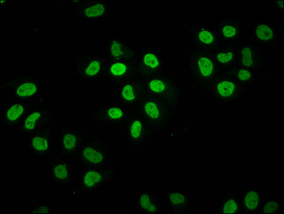 Immunofluorescence staining of Hela cells with HIST1H2BC (Ab-11) Antibody at 1:1.5, counter-stained with DAPI. The cells were fixed in 4% formaldehyde, permeabilized using 0.2% Triton X-100 and blocked in 10% normal Goat Serum. The cells were then incubated with the antibody overnight at 4°C. The secondary antibody was Alexa Fluor 488-congugated AffiniPure Goat Anti-Rabbit IgG(H+L).Rabbit anti-Human HIST1H2BC Polyclonal Antibody