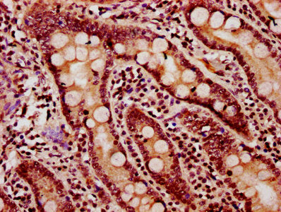 IHC image of the antibody diluted at 1:20 and staining in paraffin-embedded human small intestine tissue performed on a Leica BondTM system. After dewaxing and hydration, antigen retrieval was mediated by high pressure in a citrate buffer (pH 6.0). Section was blocked with 10% normal goat serum 30min at RT. Then primary antibody (1% BSA) was incubated at 4°C overnight. The primary is detected by a biotinylated secondary antibody and visualized using an HRP conjugated SP system.Rabbit anti-Human HIST1H2BC Polyclonal Antibody