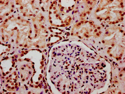 IHC image of HIST1H2BC (Ab-11) Antibody diluted at 1:20 and staining in paraffin-embedded human kidney tissue performed on a Leica BondTM system. After dewaxing and hydration, antigen retrieval was mediated by high pressure in a citrate buffer (pH 6.0). Section was blocked with 10% normal goat serum 30min at RT. Then primary antibody (1% BSA) was incubated at 4°C overnight. The primary is detected by a biotinylated secondary antibody and visualized using an HRP conjugated SP system.Rabbit anti-Human HIST1H2BC Polyclonal Antibody