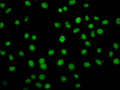 Immunofluorescence staining of Hela cells with HIST1H2BC (Ab-11) Antibody at 1:1, counter-stained with DAPI. The cells were fixed in 4% formaldehyde, permeabilized using 0.2% Triton X-100 and blocked in 10% normal Goat Serum. The cells were then incubated with the antibody overnight at 4°C. The secondary antibody was Alexa Fluor 488-congugated AffiniPure Goat Anti-Rabbit IgG(H+L).Rabbit anti-Human HIST1H2BC Polyclonal Antibody