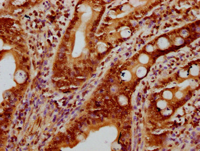 IHC image of the antibody diluted at 1:10 and staining in paraffin-embedded human small intestine tissue performed on a Leica BondTM system. After dewaxing and hydration, antigen retrieval was mediated by high pressure in a citrate buffer (pH 6.0). Section was blocked with 10% normal goat serum 30min at RT. Then primary antibody (1% BSA) was incubated at 4°C overnight. The primary is detected by a biotinylated secondary antibody and visualized using an HRP conjugated SP system.Rabbit anti-Human HIST1H2BC Polyclonal Antibody
