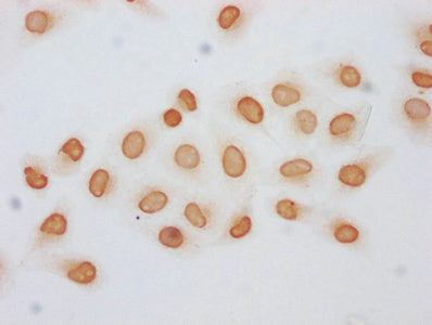 Immunocytochemistry analysis of the antibody diluted at 1:5 and staining in Hela cells (treated with 30mM sodium butyrate for 4h) performed on a Leica BondTM system. The cells were fixed in 4% formaldehyde, permeabilized using 0.2% Triton X-100 and blocked with 10% normal goat serum 30min at RT. Then primary antibody (1% BSA) was incubated at 4°C overnight. The primary is detected by a biotinylated secondary antibody and visualized using an HRP conjugated SP system.Rabbit anti-Human HIST1H2BC Polyclonal Antibody