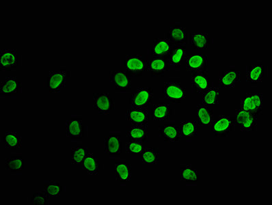 Immunofluorescence staining of Hela cells (treated with 30mM sodium butyrate for 4h) with Acetyl-HIST1H2BC (K120) Antibody at 1:2.5, counter-stained with DAPI. The cells were fixed in 4% formaldehyde, permeabilized using 0.2% Triton X-100 and blocked in 10% normal Goat Serum. The cells were then incubated with the antibody overnight at 4°C. The secondary antibody was Alexa Fluor 488-congugated AffiniPure Goat Anti-Rabbit IgG(H+L).Rabbit anti-Human HIST1H2BC Polyclonal Antibody