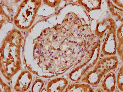 IHC image of HIST1H2BC (Ab-120) Antibody diluted at 1:20 and staining in paraffin-embedded human kidney tissue performed on a Leica BondTM system. After dewaxing and hydration, antigen retrieval was mediated by high pressure in a citrate buffer (pH 6.0). Section was blocked with 10% normal goat serum 30min at RT. Then primary antibody (1% BSA) was incubated at 4°C overnight. The primary is detected by a biotinylated secondary antibody and visualized using an HRP conjugated SP system.Rabbit anti-Human HIST1H2BC Polyclonal Antibody
