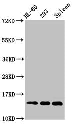 Western Blot  | Positive WB detected in: HL60 whole cell lysate, 293 whole cell lysate, Rat spleen tissue  | All lanes: HIST1H2BC antibody at 1µg/ml  | Secondary  | Goat polyclonal to rabbit IgG at 1/50000 dilution  | Predicted band size: 14 kDa  | Observed band size: 14 kDaRabbit anti-Human HIST1H2BC Polyclonal Antibody
