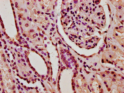 IHC image of HIST1H2BC (Ab-120) Antibody diluted at 1:20 and staining in paraffin-embedded human kidney tissue performed on a Leica BondTM system. After dewaxing and hydration, antigen retrieval was mediated by high pressure in a citrate buffer (pH 6.0). Section was blocked with 10% normal goat serum 30min at RT. Then primary antibody (1% BSA) was incubated at 4°C overnight. The primary is detected by a biotinylated secondary antibody and visualized using an HRP conjugated SP system.Rabbit anti-Human HIST1H2BC Polyclonal Antibody